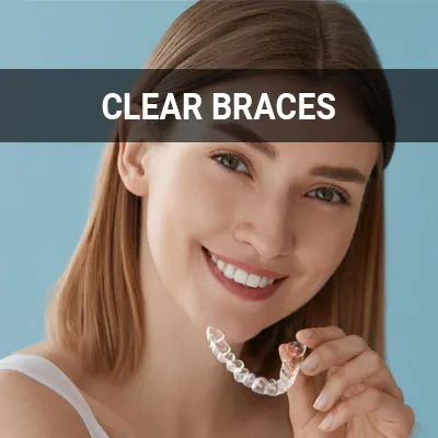 Clear Braces