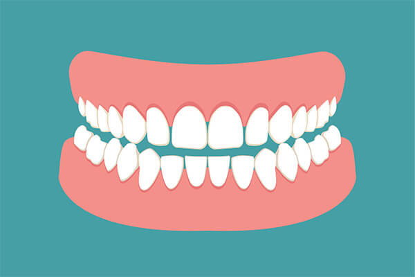 The FAQ’s of Denture Care