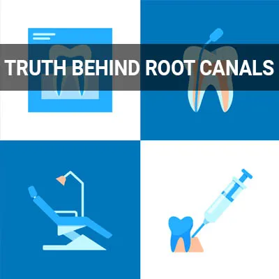 truth behind root canals