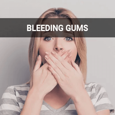 gums bleeding