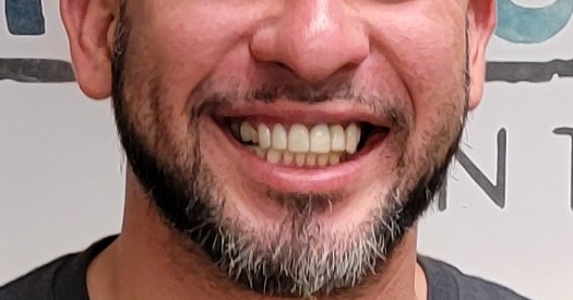 smile gallery image
