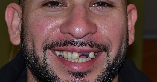 smile gallery image