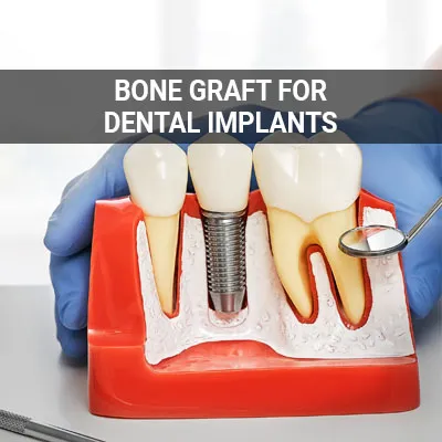 bone graft