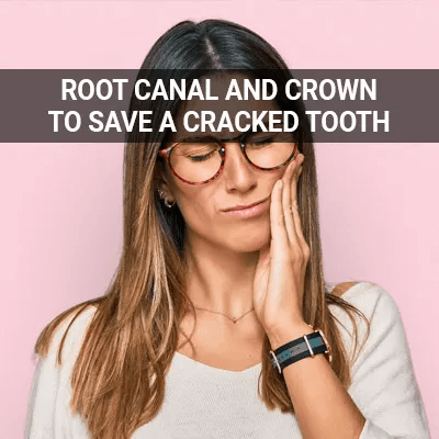 root canal