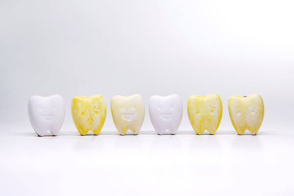Stained Teeth