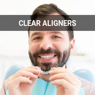 clear aligners