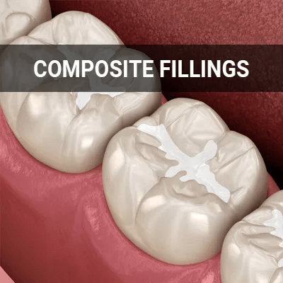composite filing