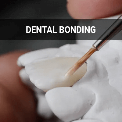 dental bonding