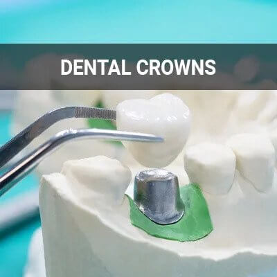 Dental Crowns