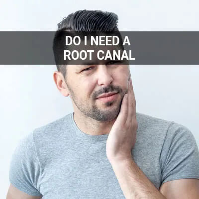 root canal