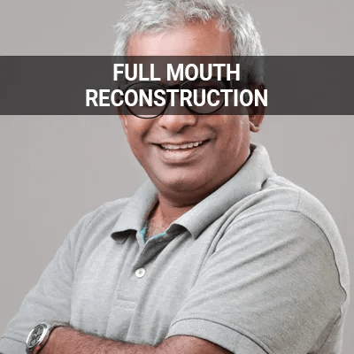 full mouth recon