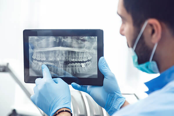 Dental X-rays 