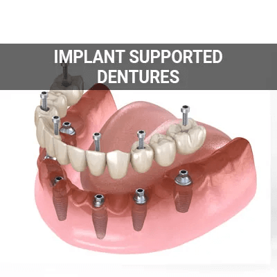 implant animation