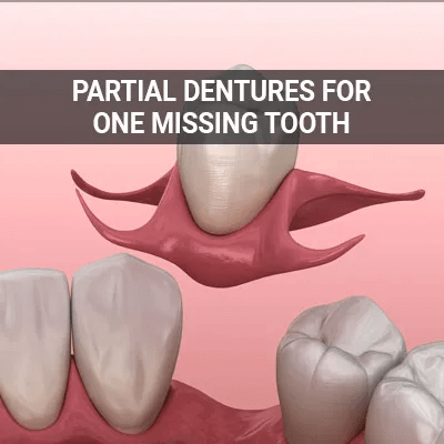 partial-dentures