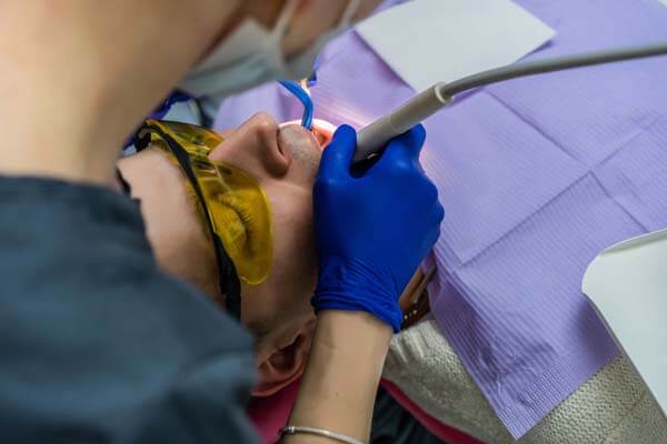 Teeth Whitening 