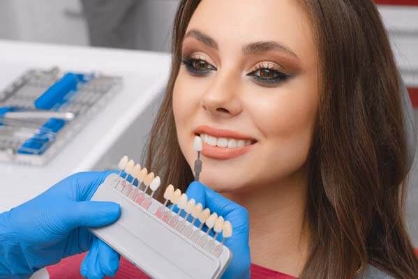 Veneers