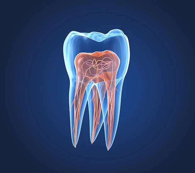 What is an Endodontist