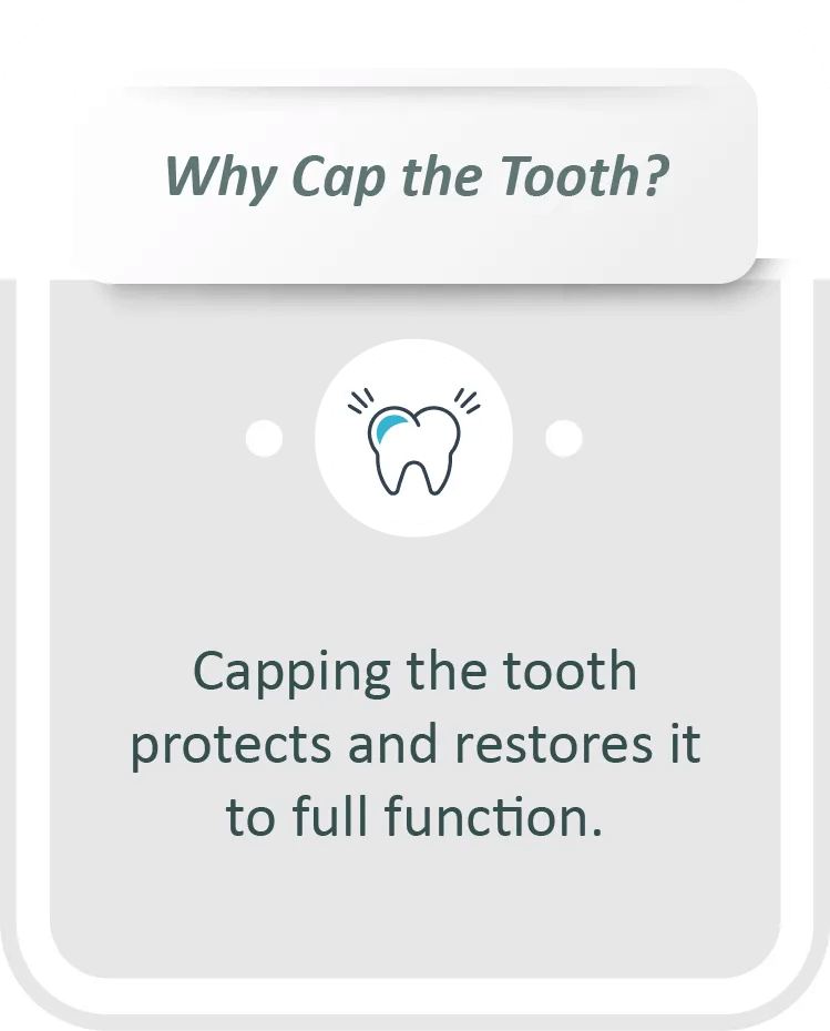 cap tooth